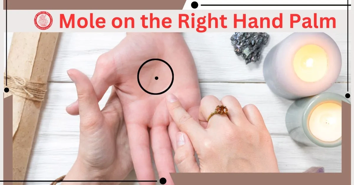 Mole on the right hand palm